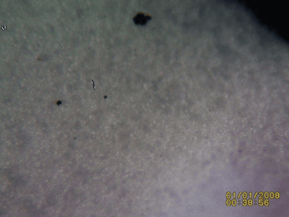 Figure 14_Post Flush Sample 4