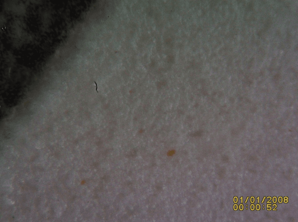 Figure 3_Post Flushing Oil Sample 1