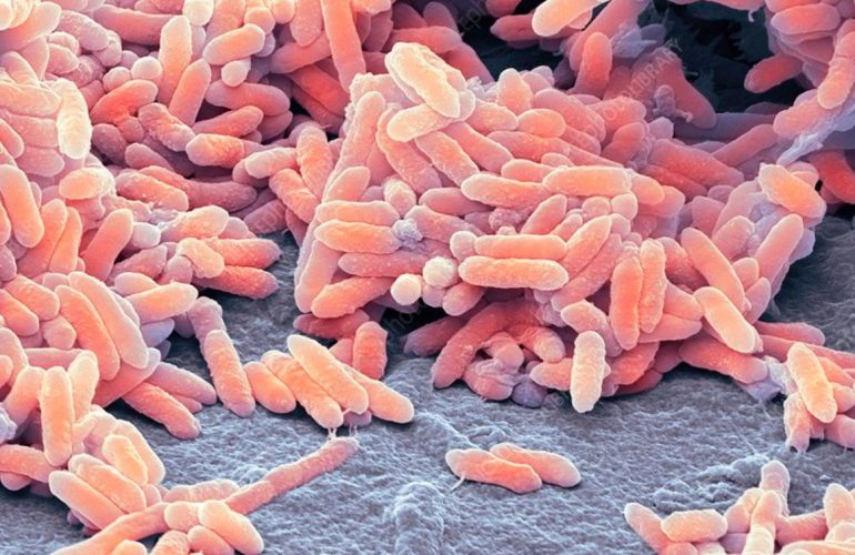 Managing Microbial Contamination in Industrial Lubricants